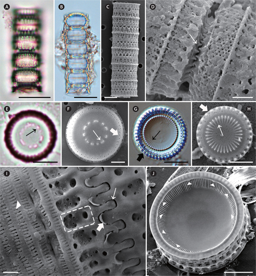 Micrographs of Paralia sulcata taken using light microscopy (A, B, E & G) and scanning electron microscopy (C, D, F & H-J). (A-C) Girdle view of chained cells. Upper (A) and middle (B) focus girdle view of the specimen. (D) Girdle view of interlocked, sibling, separation valves. Wedgeshaped internal linking spines (thin arrow). (E) Valve view of separation valve. Irregular pattern of internal linking spines (thin arrow). (F) Valve view of separation valve. Irregular pattern of internal linking spines (thin arrow), marginal pore (thick arrow). (G) Valve view of intercalary valve. Internal linking spines (thin arrow), marginal pore (thick arrow). (H) Valve view of intercalary valve with interlocking radiating processes. Internal linking spines (thin arrow), marginal pore (thick arrow). (I) Girdle view of intercalary valve. Slender, spatula, rounded tips of internal linking spines (thin arrow) in relief valve; flat tip of marginal linking spines (thick arrow) in intaglio valve; obscure fenestrae (dashed square); slits in copulae (arrowhead). (J) Internal valve view with internal striae and rimoportulae. Rimoportula (arrowheads). Scale bars represent: A, B, E & G, 10 μm; C, F, H & J, 5 μm; D, 2 μm; I, 1 μm.