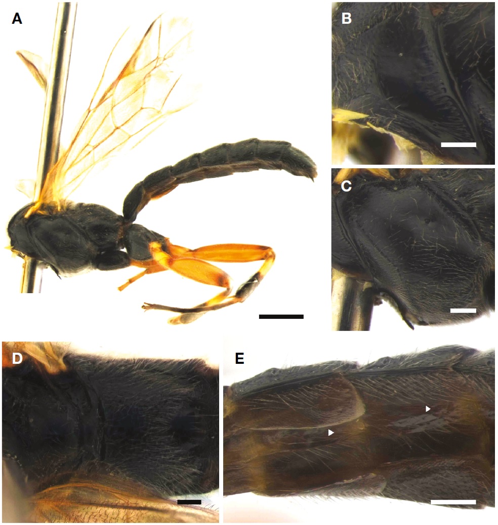 A-E, Pimpla albociliata Kasparyan, 1974. A, Habitus of male in lateral view; B, Pronotum of male in lateral view; C, Mesopleuron of male in lateral view; D, Sculletum to propodeum of male in dorsal view; E, 2nd-3rd epipleuron of male in ventral view (area indicated by triangle shaped mark). Scale bars: A, B=1 mm, C-E=0.2 mm.