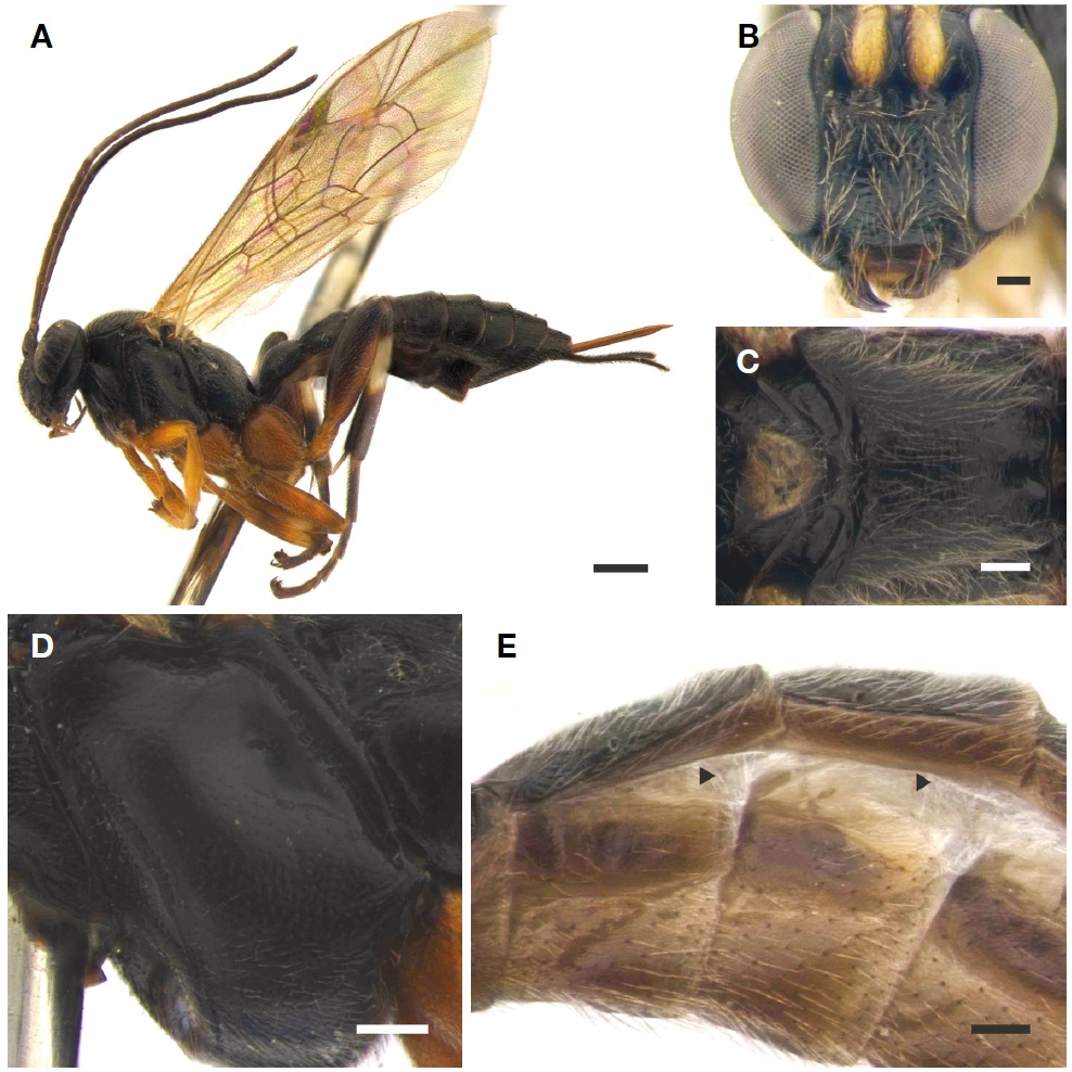 A-E, Pimpla femorella Kasparyan, 1974. A, Habitus of female in lateral view; B, Face of male in frontal view; C, Scutellum to propodeum of male in dorsal view; D, Mesopleuron of female in lateral view; E, 2nd-3rd epipleuron of female in ventral view (area indicated by triangle shaped mark). Scale bars: A=1 mm, B-E=0.2 mm.