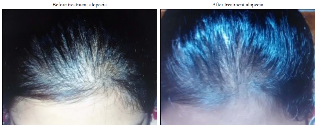 Images showing amelioration of alopecia.