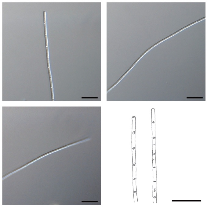 Microscopic photographs and illustrations of Limnothrix redekei (Goor) Meffert, taken from the fixed samples. Scale bars represent 10 μm.