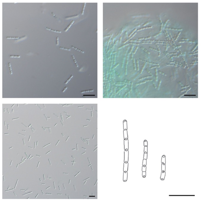 Microscopic photographs and illustrations of Pseudanabaena galeata Bocher, taken with the cultured samples from algal culture collection of Kyonggi University. Scale bars represent 10 μm.