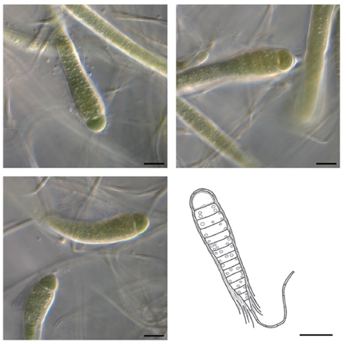 Microscopic photographs and illustrations of Calothrix parietina Thuret ex Bornet and Flahault, taken with the cultured samples from algal culture collection of Kyonggi University. Scale bars represent 10 μm.