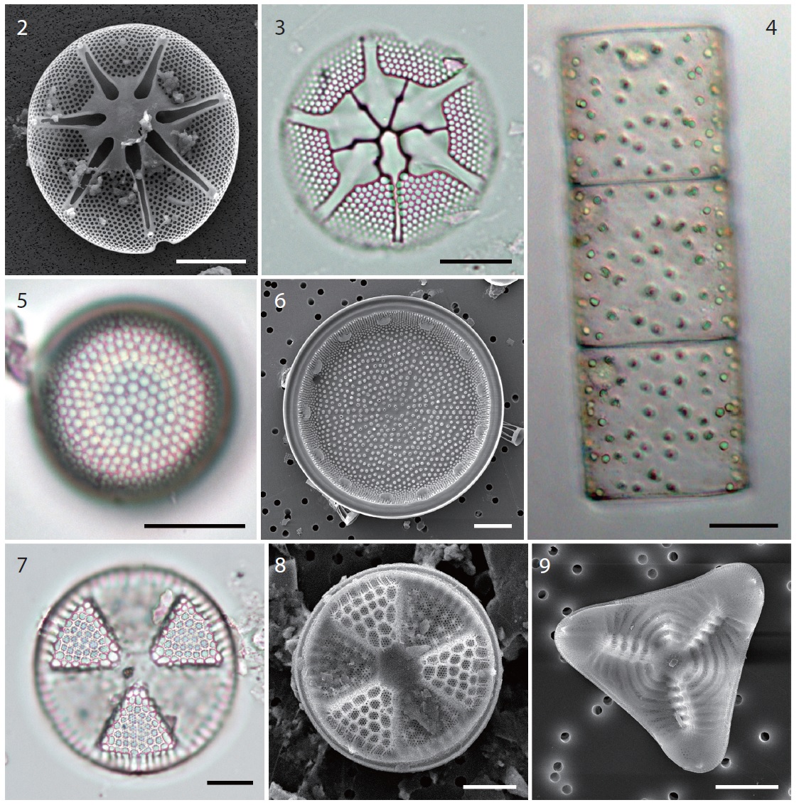 Fig. 2. Internal valve of Asterionellopsis hyalina in SEM. Fig. 3. Asterionellopsis parvula in LM. Fig. 4. Pseudoguinardia recta in LM. Fig. 5. Actinocyclus exiguus in LM. Fig. 6. Internal valve of Actinocyclus sp. Fig. 7. Actinoptychus aster in LM. Fig. 8. External valve of Actinoptychus aster in SEM. Fig. 9. External valve of Schuettia annulata var. minor. Scale bars represent: Figs. 2, 3 & 5？10, 10 μm; Fig. 4, 20 μm.