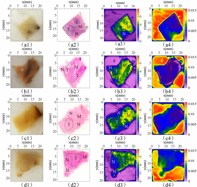 Optical photographs of the four paraffin-embedded prostate cancer tissues (column 1), H-E staining (column 2) and THz images (columns 3 and 4). The THz images were obtained using frequency domain absorption coefficient imaging (column 3, 1.2 THz) and time-domain peak-to-peak imaging (column 4). The selected pixels are indicated in column 2 and column 3 (T: tumor tissue, N: normal prostate tissue, M: smooth muscle tissue).